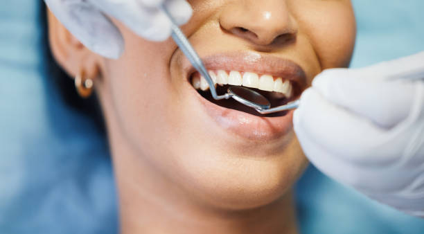 Best Dental Abscess Treatment in Caldwell, ID